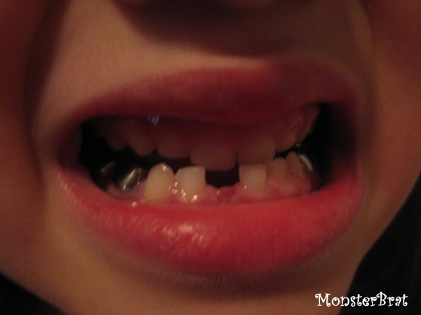 tooth1